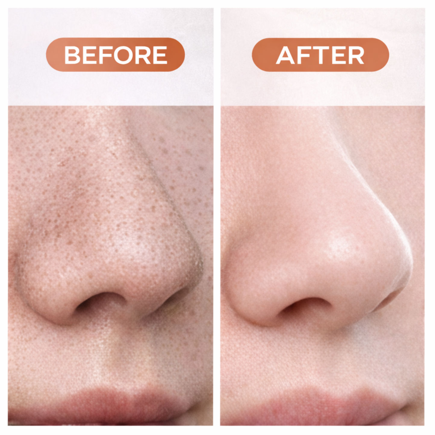 Deep Pore Blackhead Remover