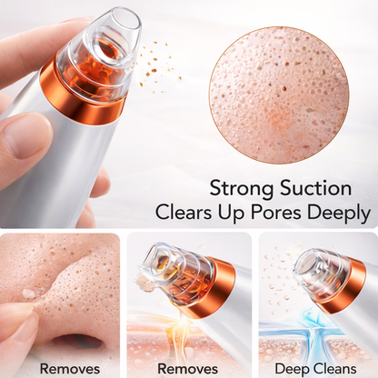 Deep Pore Blackhead Remover
